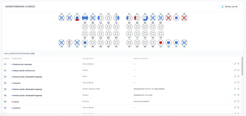 Captura del odontograma clínico en Galenicos: notación FDI por pieza y cara, dictado con IA y tabla de hallazgos.